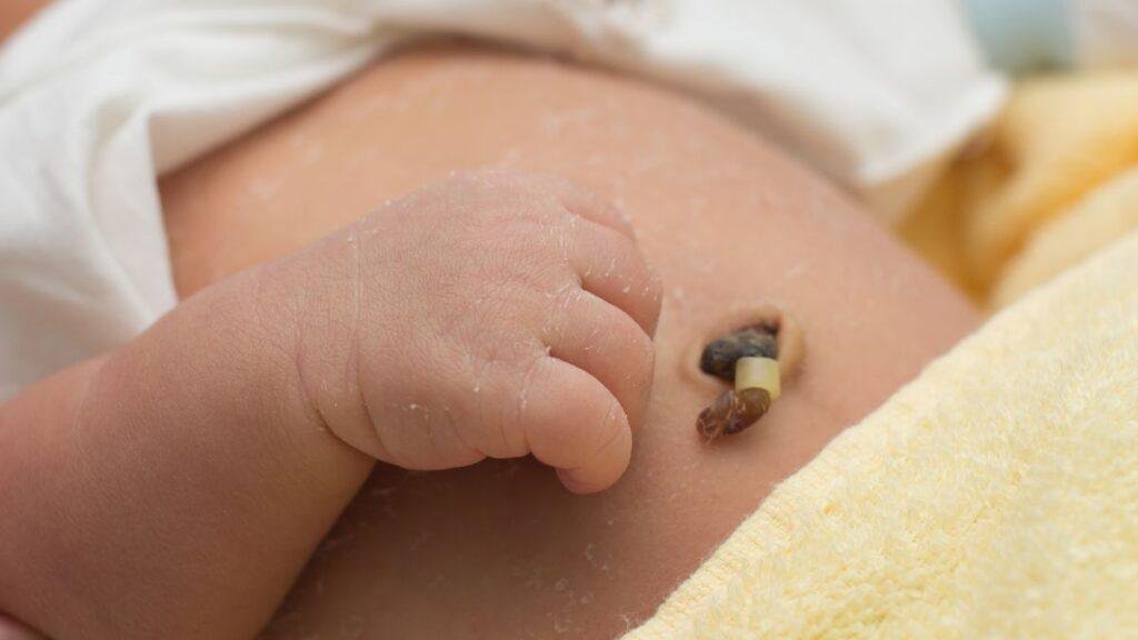 Baby ritual to preserve a portion of the umbilical cord